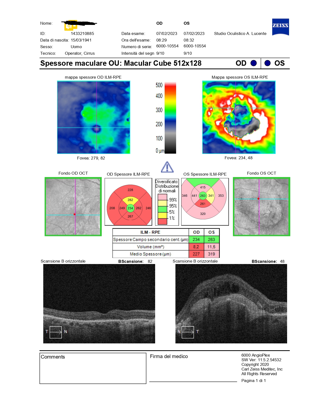 RNFL e Cellule gangliari in macula